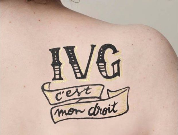 ivg